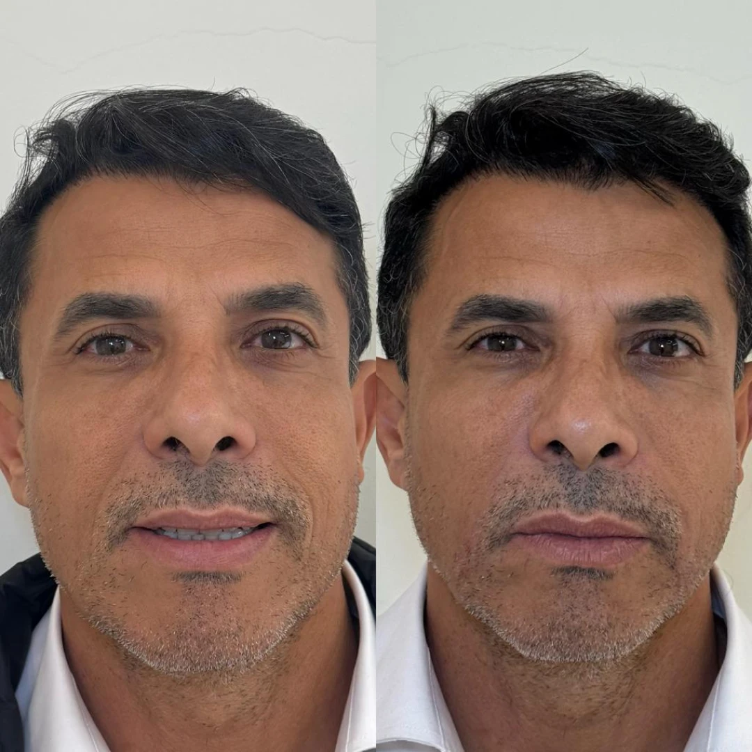 face (1)
